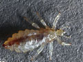 head louse